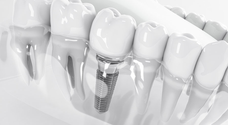 Zahnartpraxis Marion Stopperka - für zufriedene Patienten